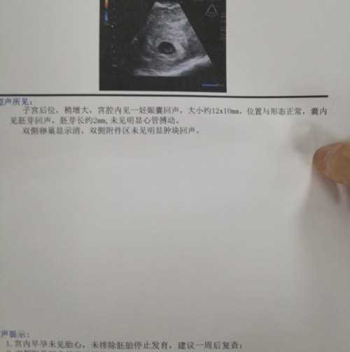 私人供卵医院,北京市供卵试管助孕机构,国内合法供卵试管中心找喜果助孕