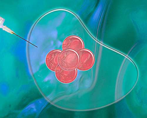 知名辅助生殖技术专家指南