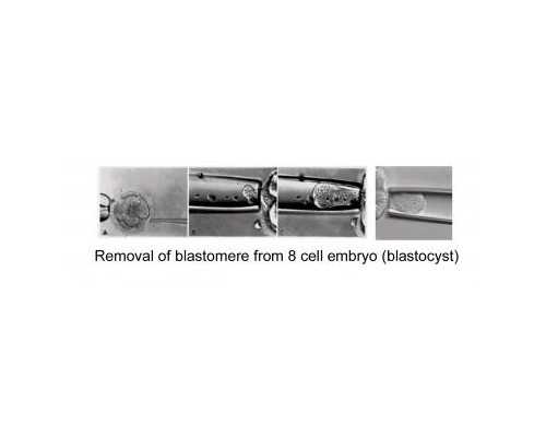 南宁第三代试管助孕：全面解析费用、流程与成功率