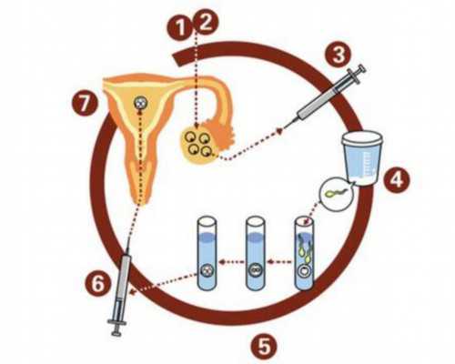 哪些人群适合试管婴儿助孕？