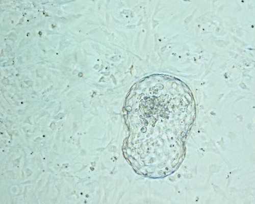 南宁助孕指南：揭秘试管婴儿饮食调理与成功率