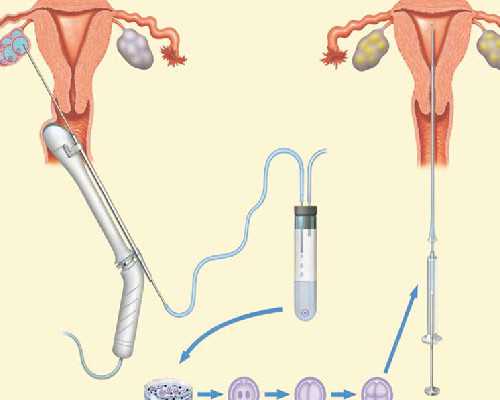 南宁试管助孕：如何判断孕早期胎儿是否健康？好胎儿的表现