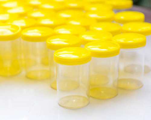 揭秘广西医科大学人类精子库:捐精流程、补助及严格标准