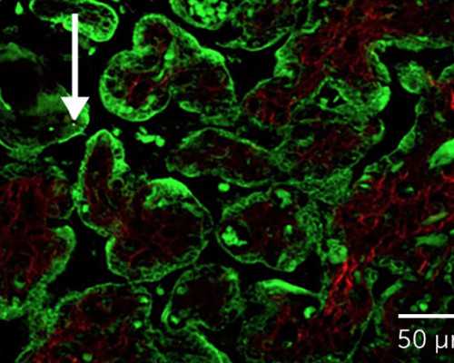 南宁生殖中心试管代怀流程指南