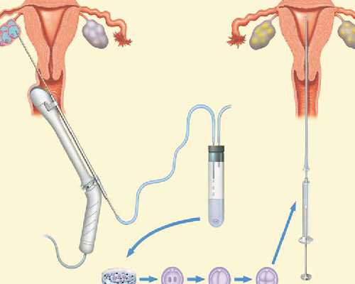 孕早期白带异常带血的潜在原因与应对策略