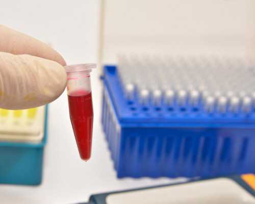 代孕套餐一对一,助孕：试管婴儿，男方取精困难怎么办？